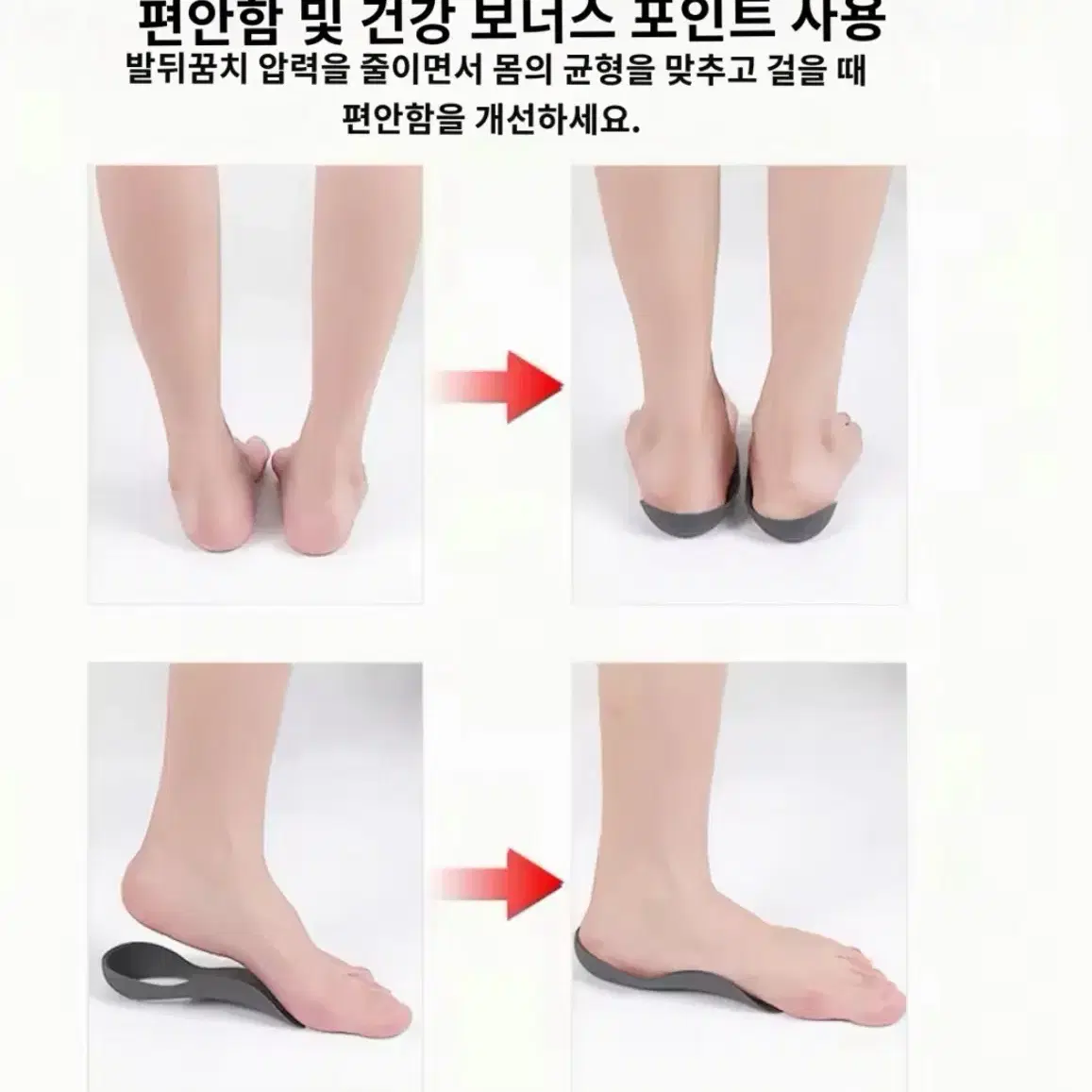 족저근막염 산발깔창