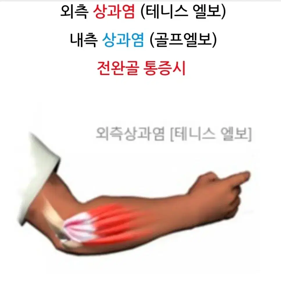 닥터메드 엘보우 보호대