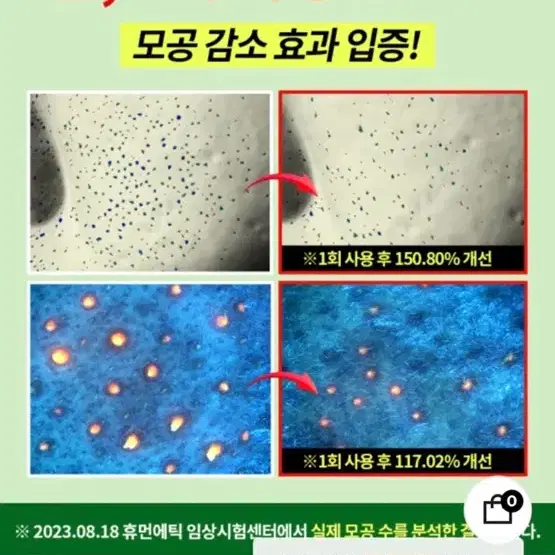 바다포도 모공앰플