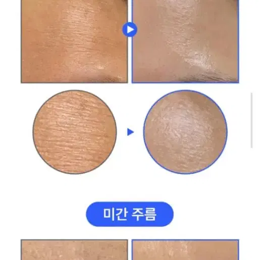 기미주름 피부장벽 세니지아 유니크미 마이크로마이옴 세라마이드 리포좀 앰플