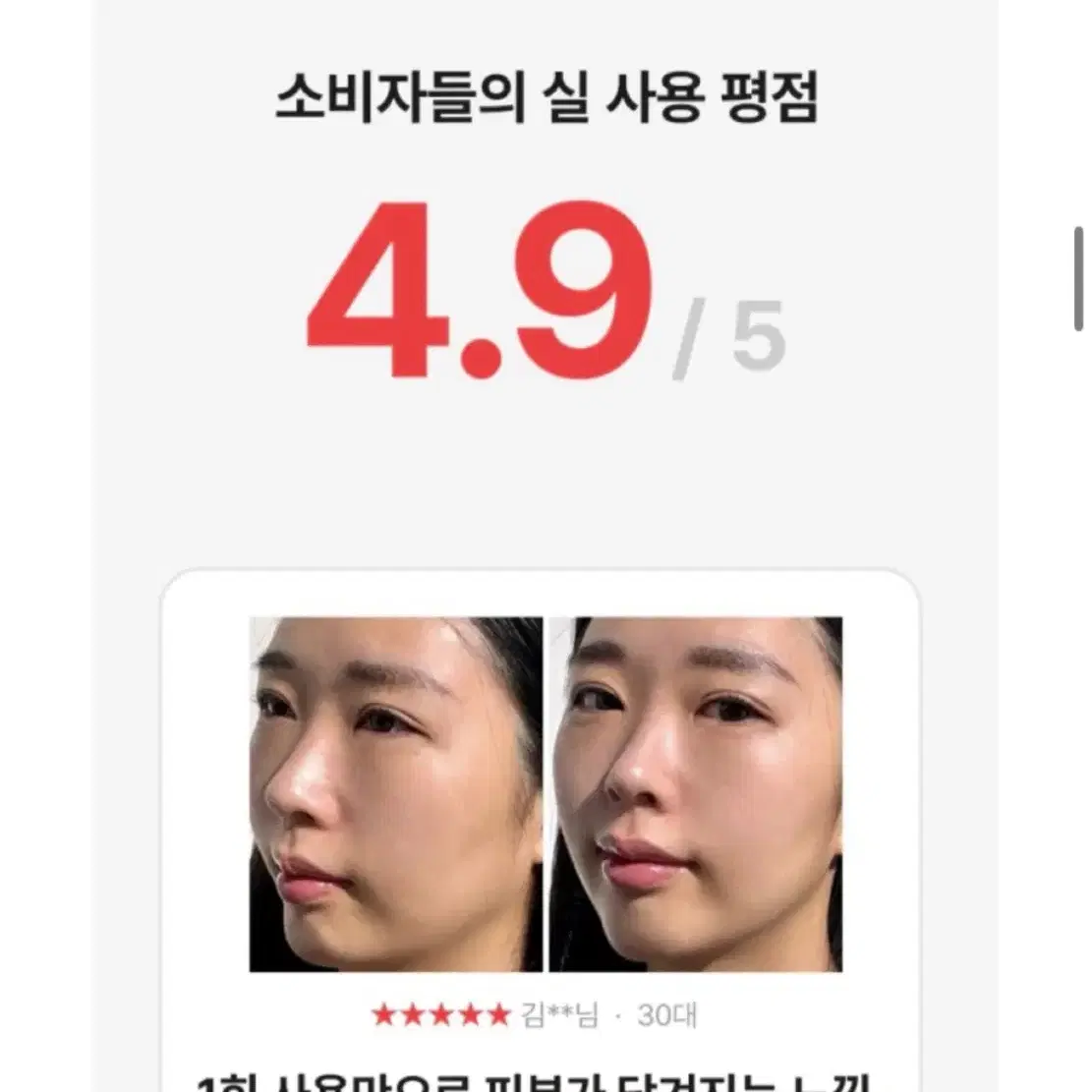 페이스팩토리 고주파 링크샷