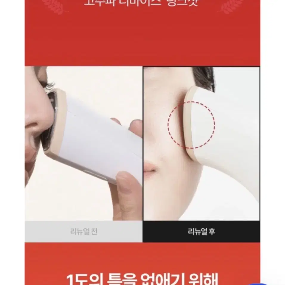 페이스팩토리 고주파 링크샷