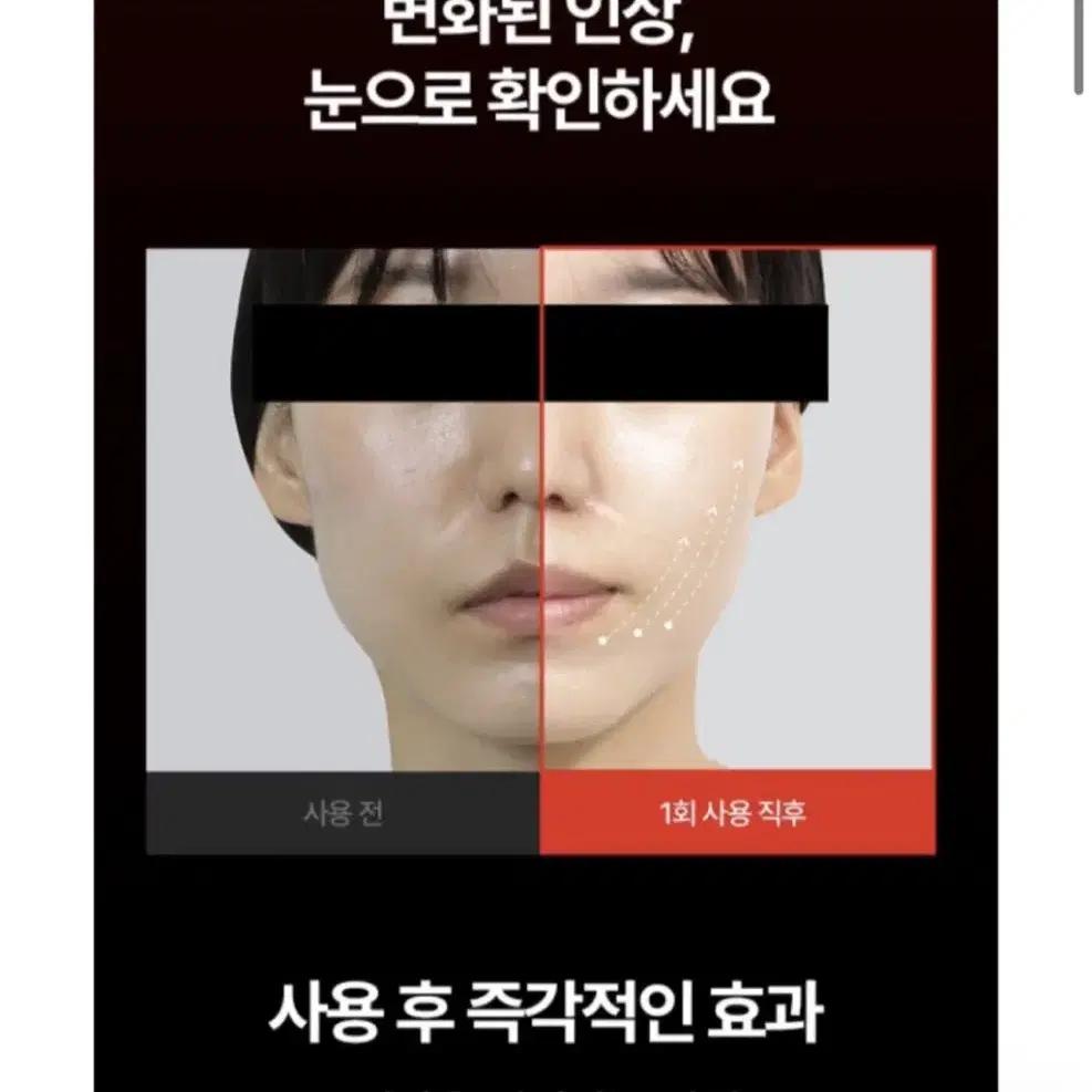 페이스팩토리 고주파 링크샷