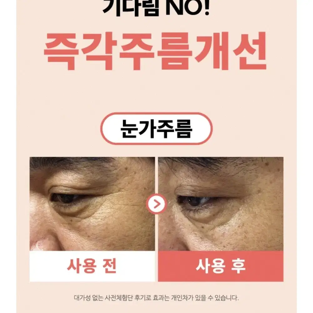 즉각주름개선 기다림No 초강력 항산화 쿼세틴 함유 수크랄페이트 앰플 세럼