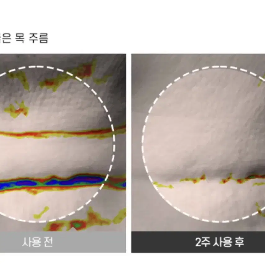 에이바자르 넥마스크