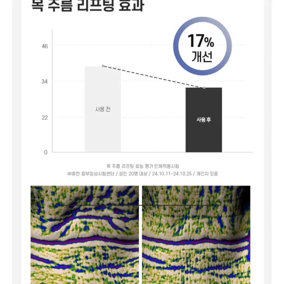 에이바자르 넥마스크