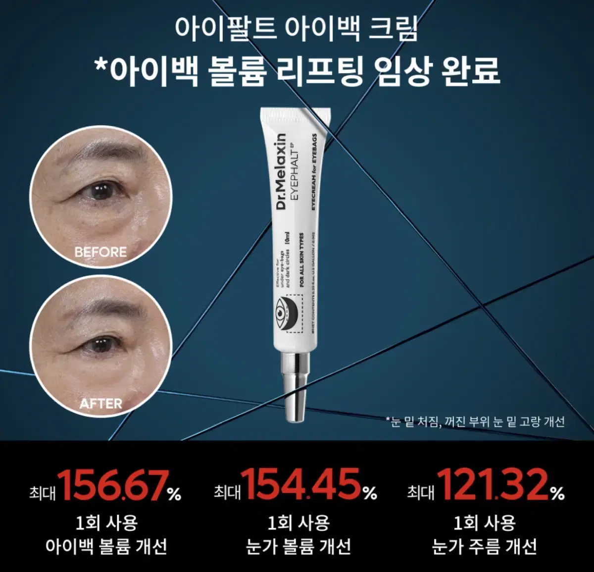 닥터멜락신 아이팔트 아이백크림 새제품