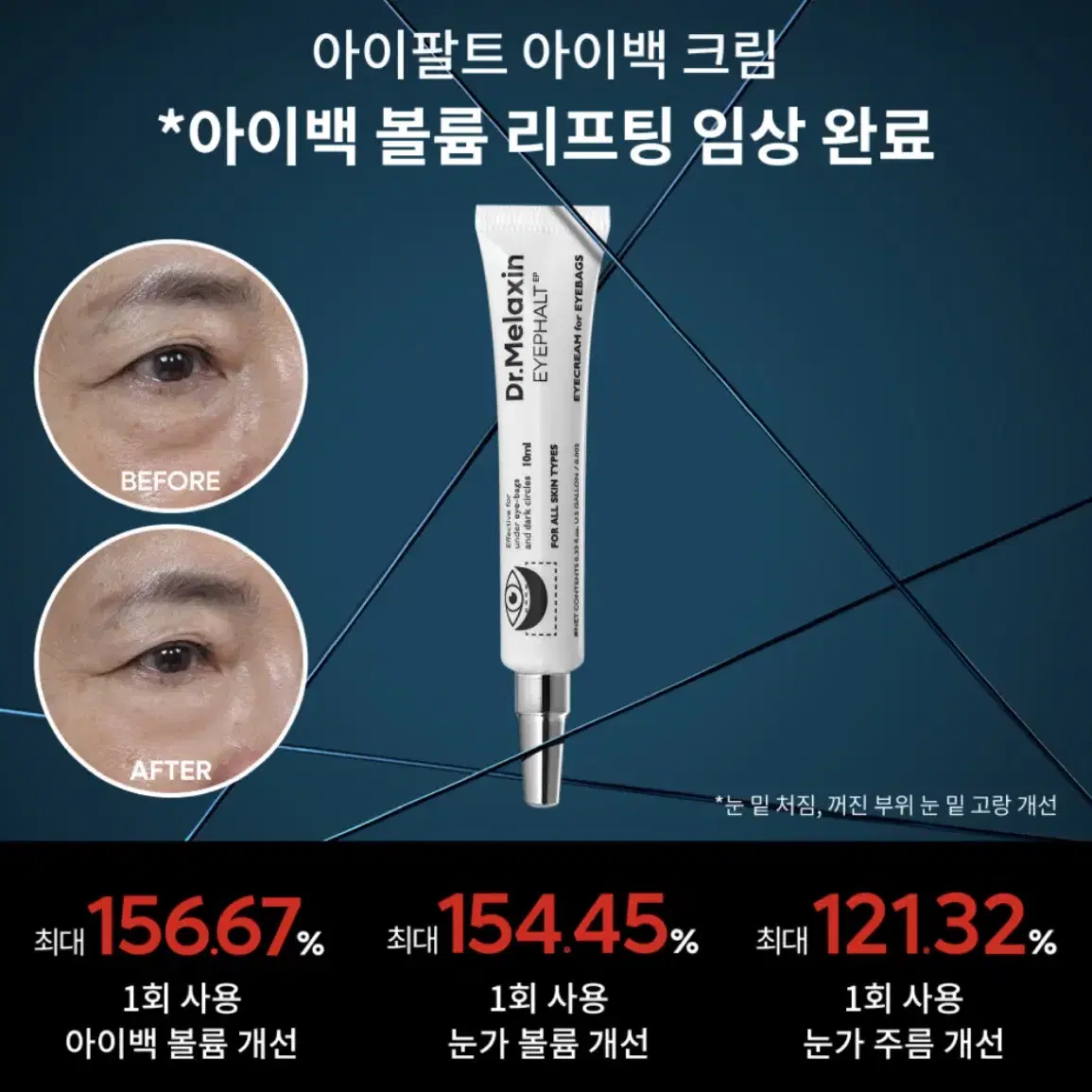 닥터멜락신 아이팔트 아이백크림 새제품