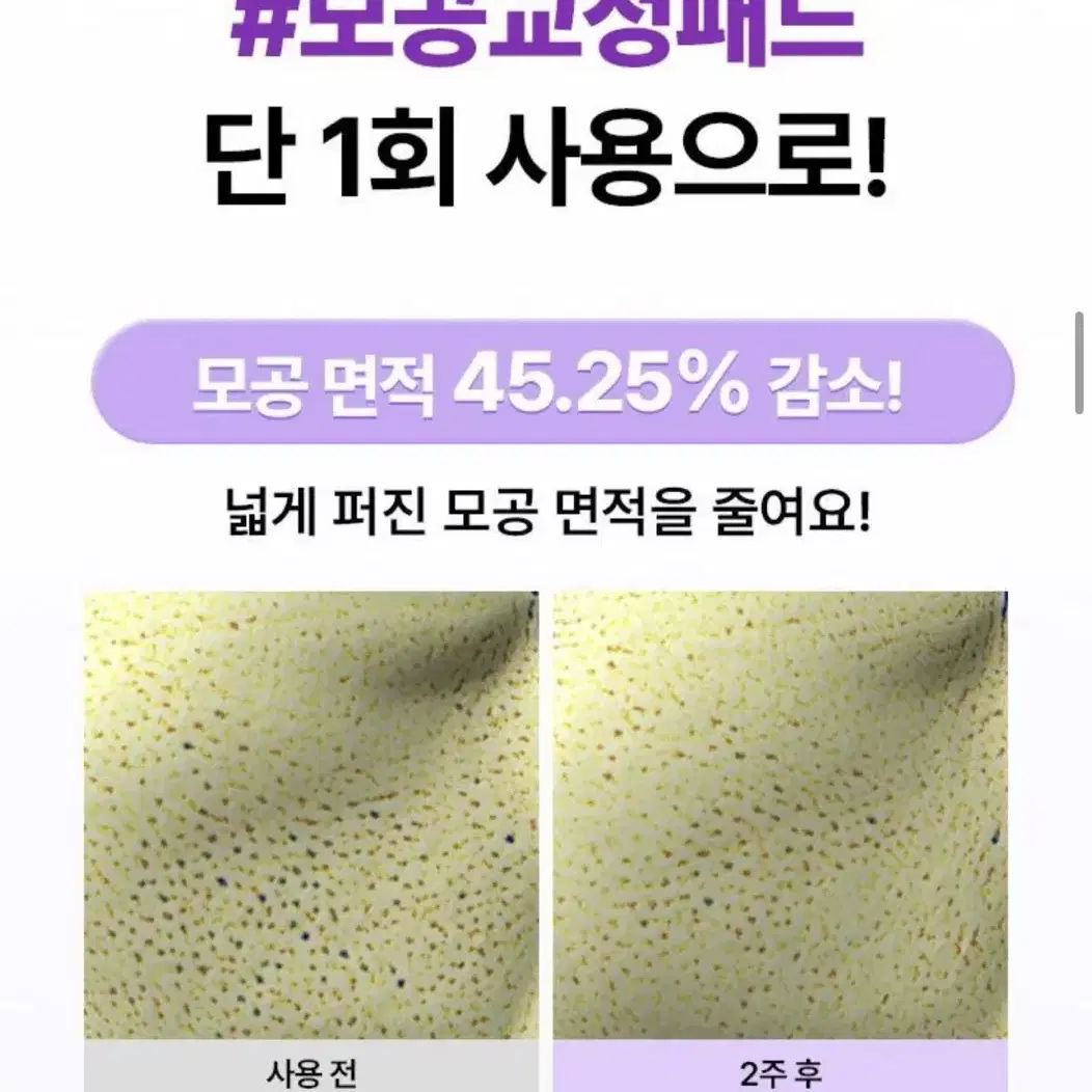 (수수료 포함 가격)바이오힐보 프로바이오덤 콜라겐 리모델링 패드