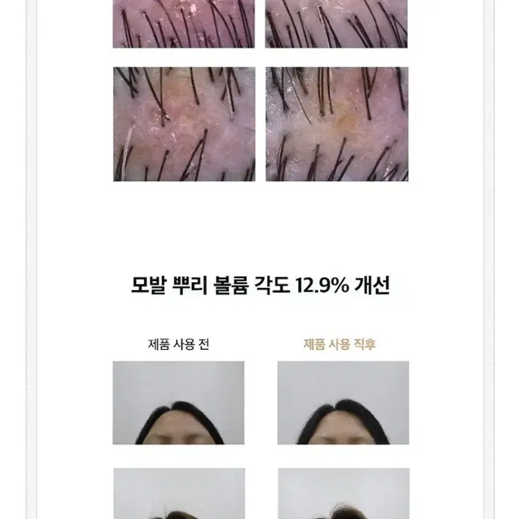 안티 헤어로스 탈모 앰플 18만원 2박스ㅡ새상품