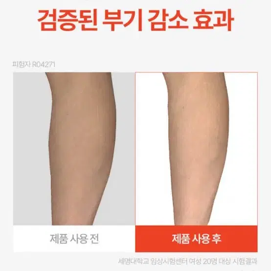 스파알 무선 종아리 마사지이