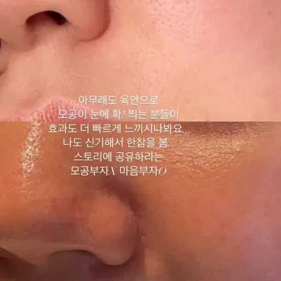 셀로라바이 모공 디바이스 기기 펜타샷