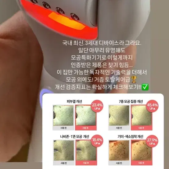 셀로라바이 모공 디바이스 기기 펜타샷