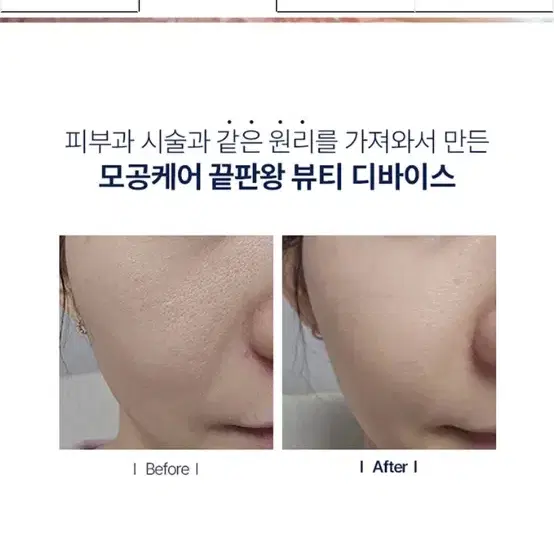 셀로라바이 모공 디바이스 기기 펜타샷