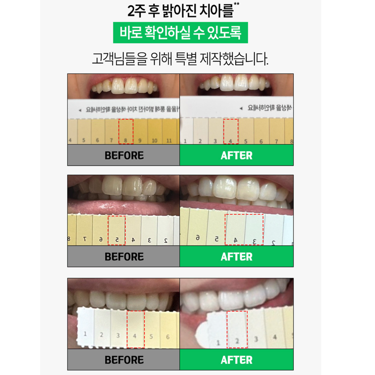 프리미엄 치아 미백 치약 화이트닝 치약 2주만에 개선 임상인증