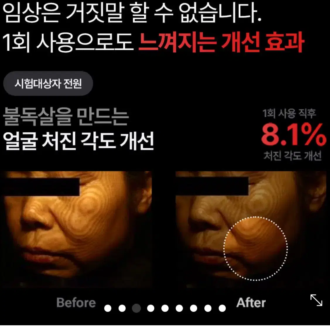 리프팅기기+골드실크림