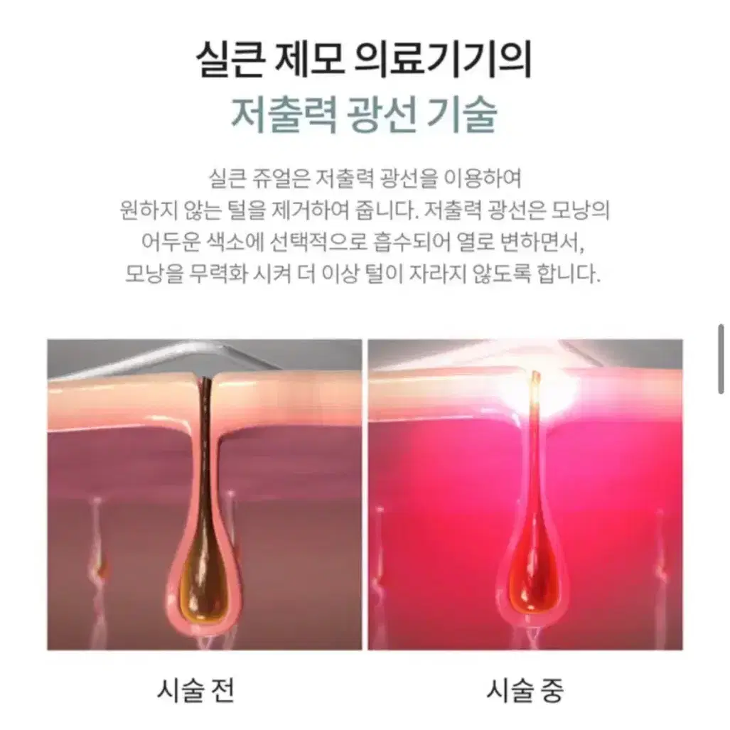 실큰 레이저 제모기