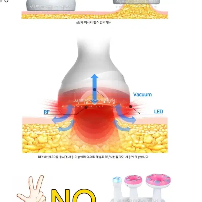 매직올 고주파 석션기 (중고)