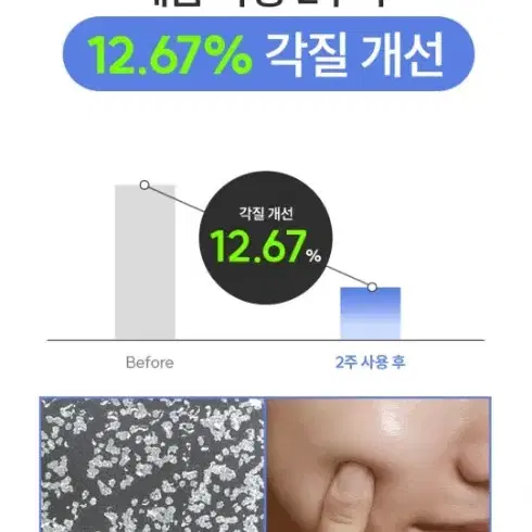 각질부자템 이퀄베리 수영장토너,각질제거 모공축소 블랙헤드 수분장벽