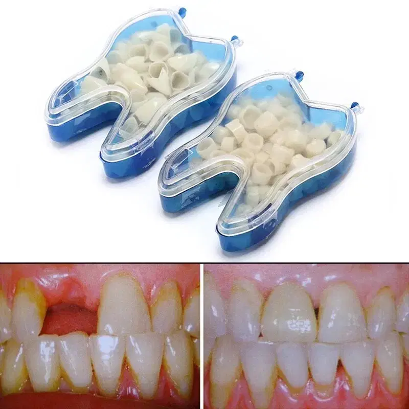 임시 크라운 치아 50개 가짜 이빨 치과 전방 후방 장비 용품
