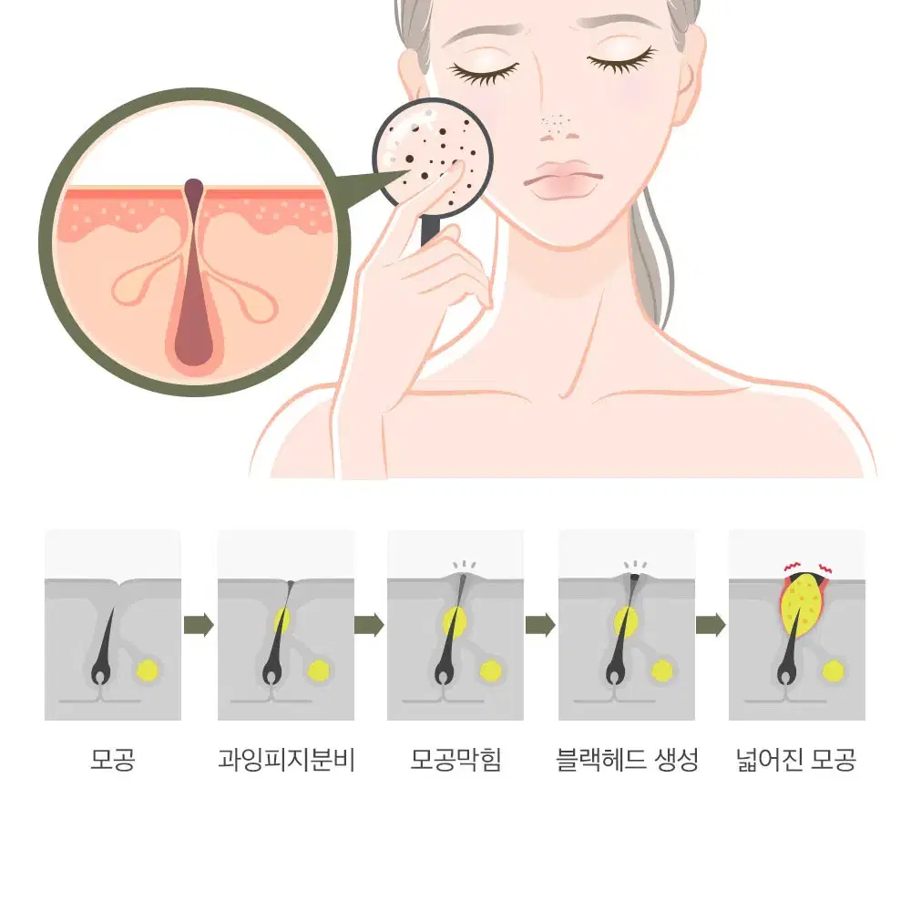 택포2500원 비건 데일리 세이프 블랙헤드 클리어 코팩 10매입