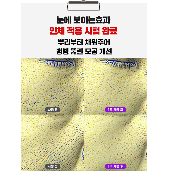 트러블 모공탄력 세럼 나비존 피지 여드름 지성 복합성피부 20+5ml올영