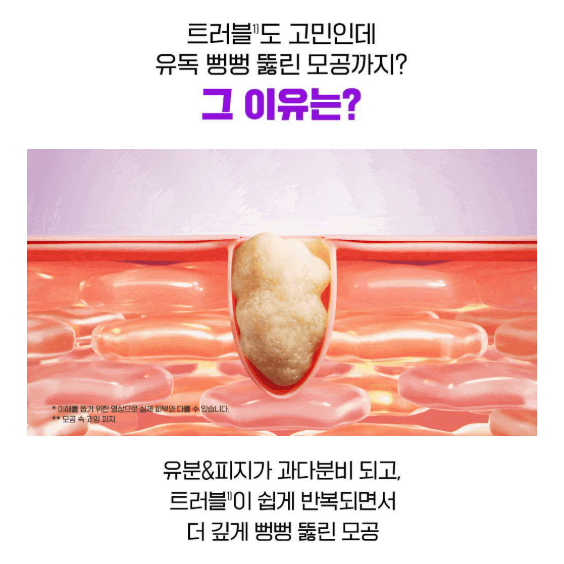 트러블 모공탄력 세럼 나비존 피지 여드름 지성 복합성피부 20+5ml올영