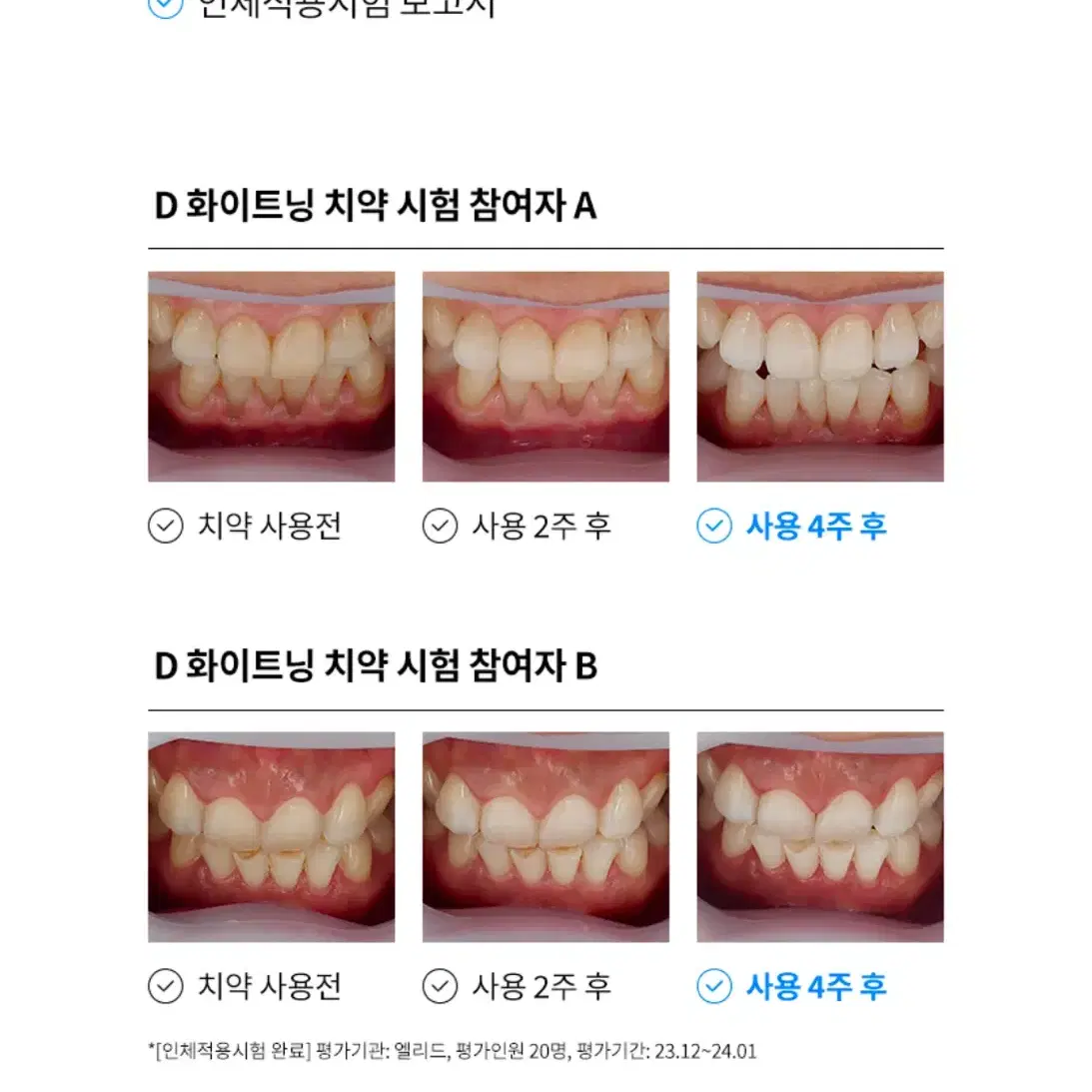 이스타14 D 화이트닝 치약