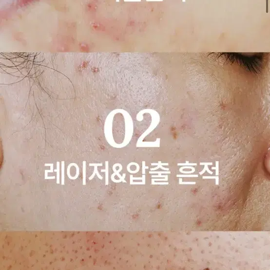 피부과1순위크림 피부흔적 크림 리메인49 egf재생병풀시카미백크림