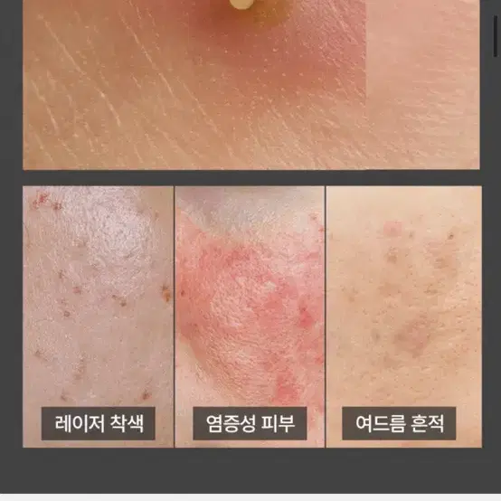 피부과1순위크림 피부흔적 크림 리메인49 egf재생병풀시카미백크림