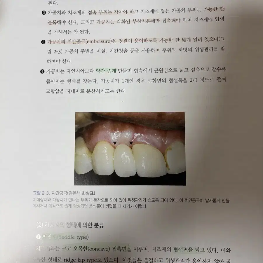 고문사) 치과보철학