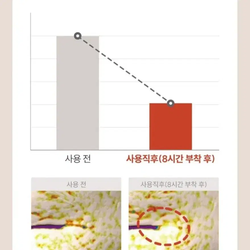 브라이언 마르시끄 링클 리페어 멀티 주름패치 세트