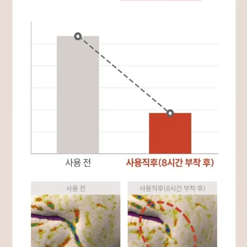 브라이언 마르시끄 링클 리페어 멀티 주름패치 세트