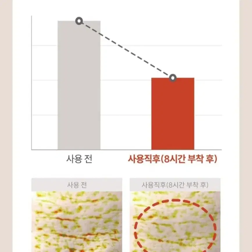 브라이언 마르시끄 링클 리페어 멀티 주름패치 세트