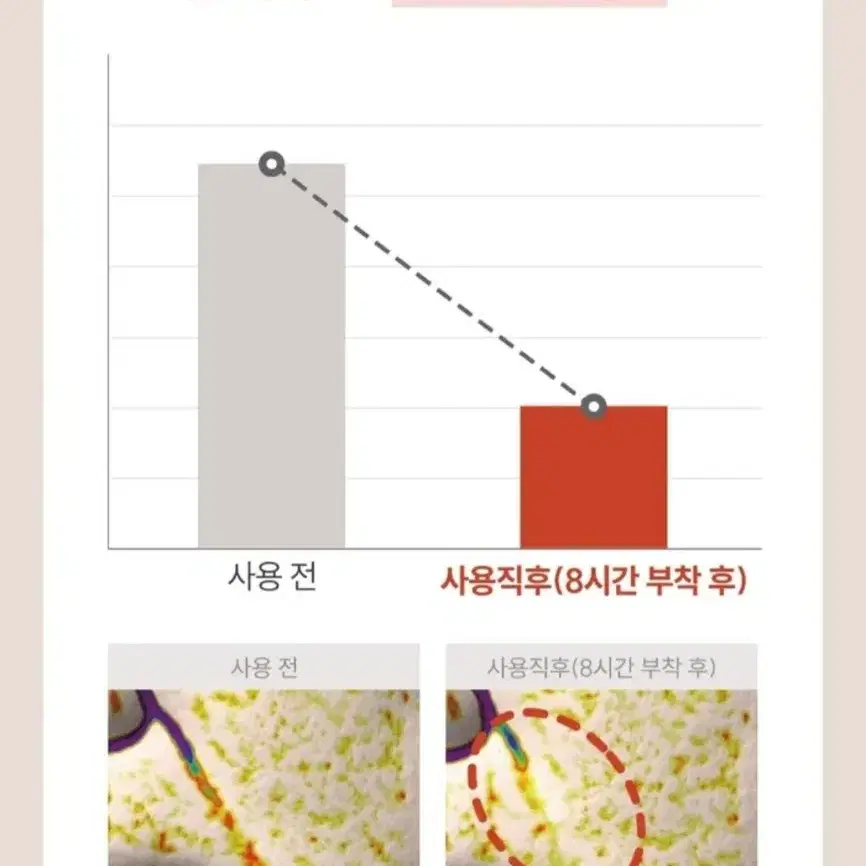 브라이언 마르시끄 링클 리페어 멀티 주름패치 세트