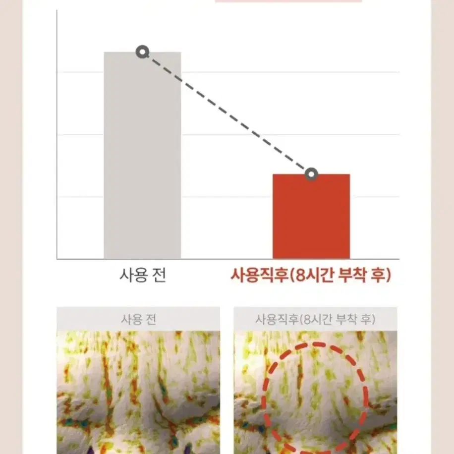 브라이언 마르시끄 링클 리페어 멀티 주름패치 세트