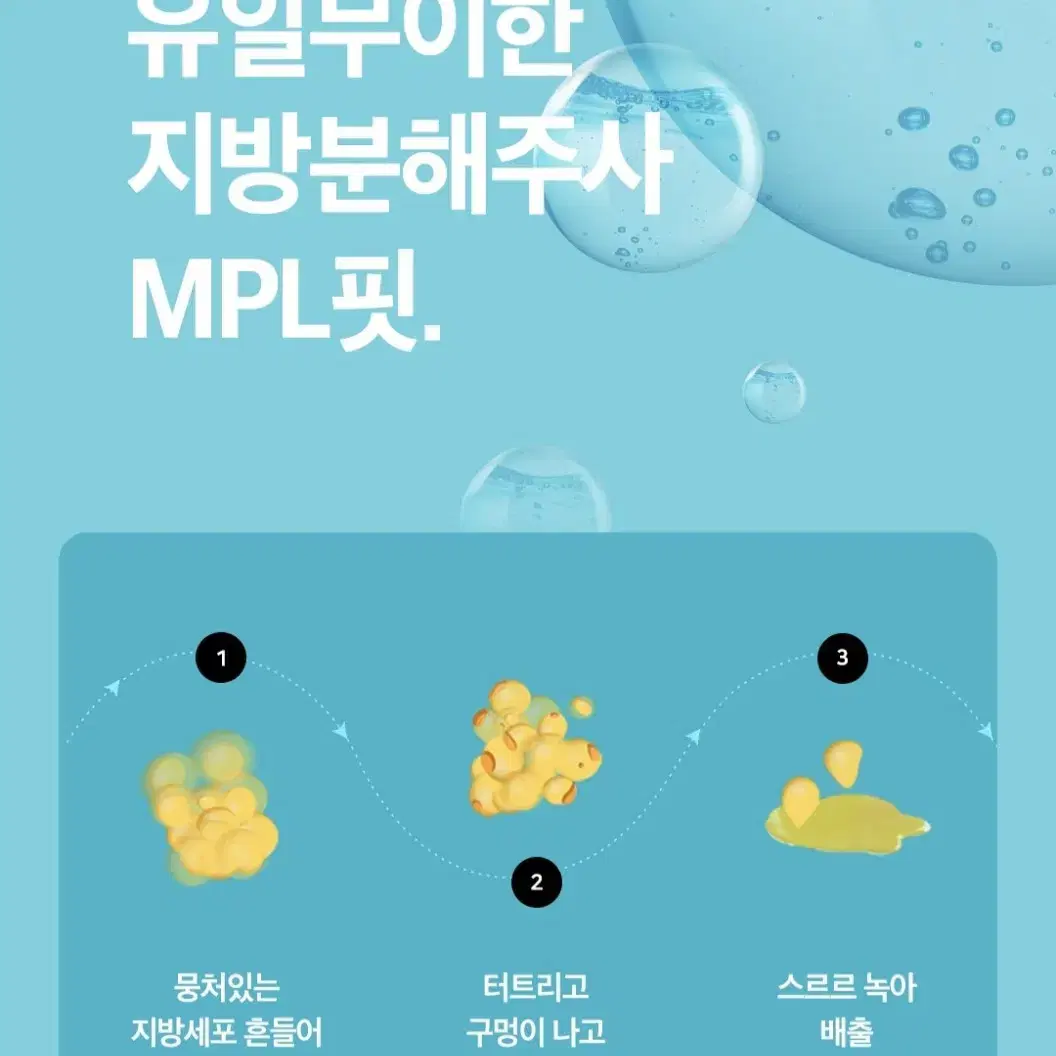 지방분해주사 MPL 4회