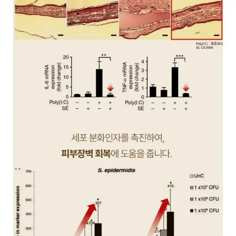 액티바이옴 탈모 샴푸 앤 트리트먼트