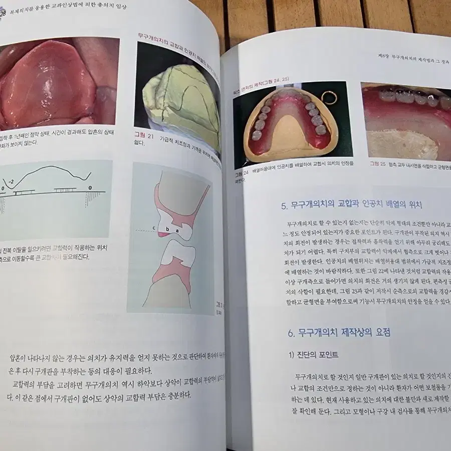 복제의치를 응용한 교좌인상법에 의한 총의치 임상