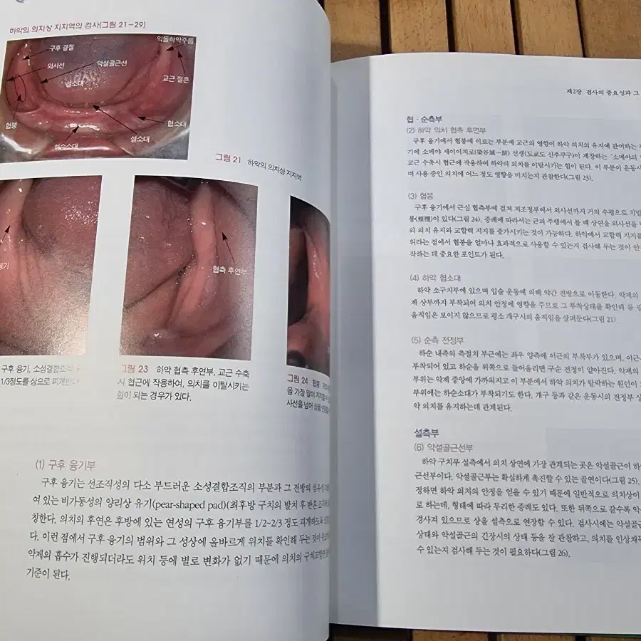 복제의치를 응용한 교좌인상법에 의한 총의치 임상