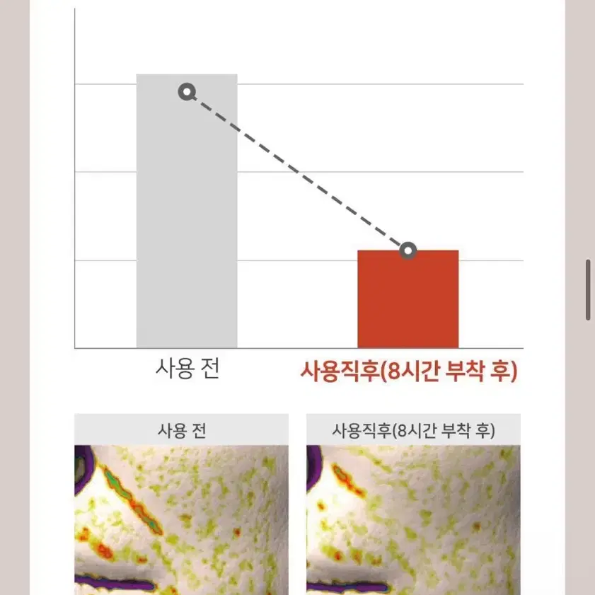 [미사용/새제품]마르시끄 링클 리페어 팔자주름 패치