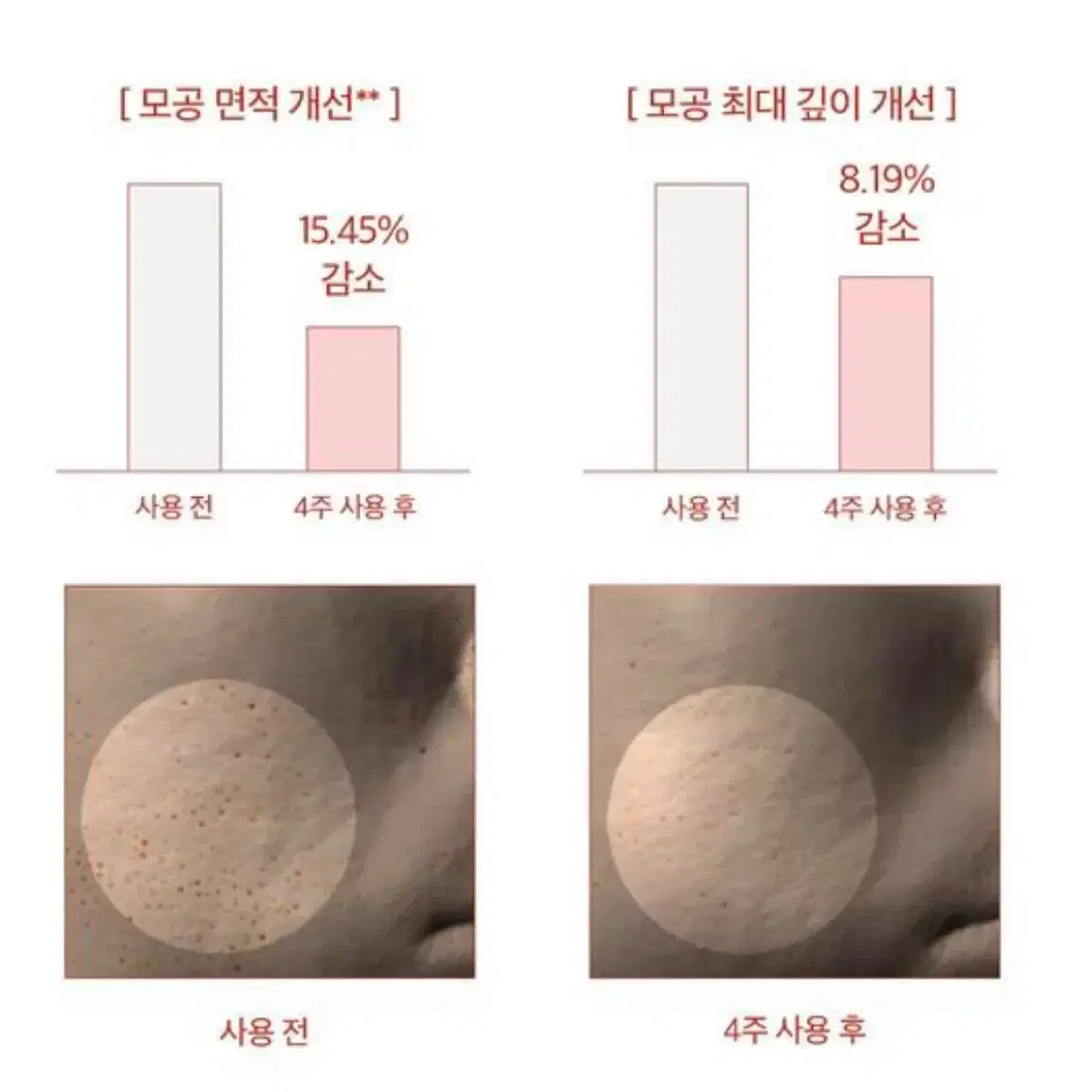 스킨1004 마다가스카르 센텔라 포어마이징 프레쉬 앰플 100ml