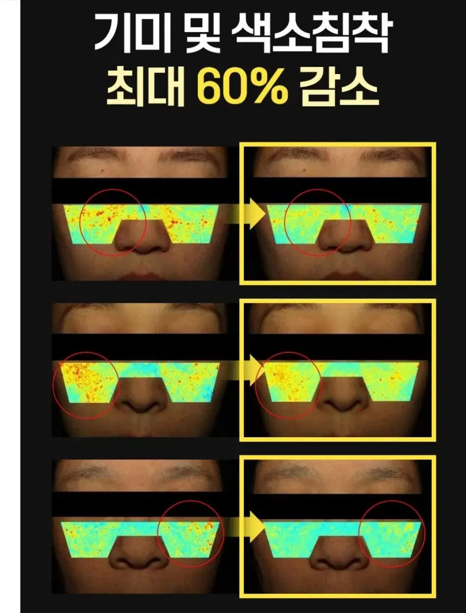 바르는보톡스 지우개 3중비타민 미백 기미 탄력 효과비타글로우 크림