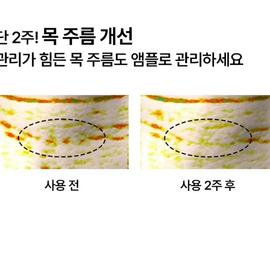 아로셀 "보툴케어" EX 키트 최신 리뉴얼