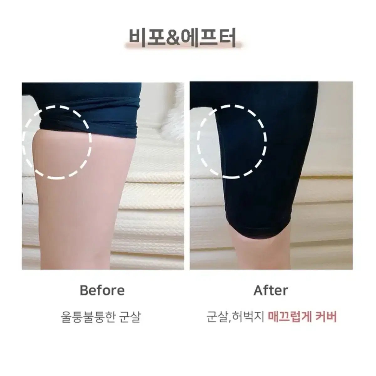 Underwear to correct inner thighs