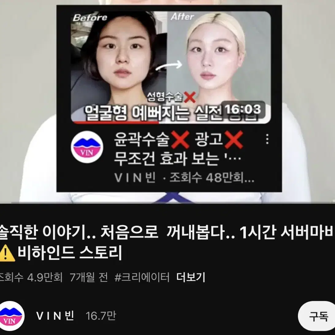 급처 마미케어 EMS 브이쎄라 흑자두크림 5개 판매