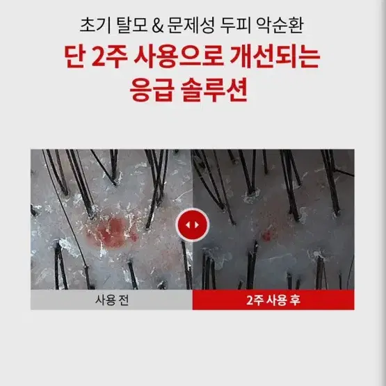 바이브랩 문제성 두피 에센스 미개봉