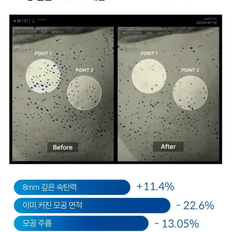 메디큐브 엑소좀 7500