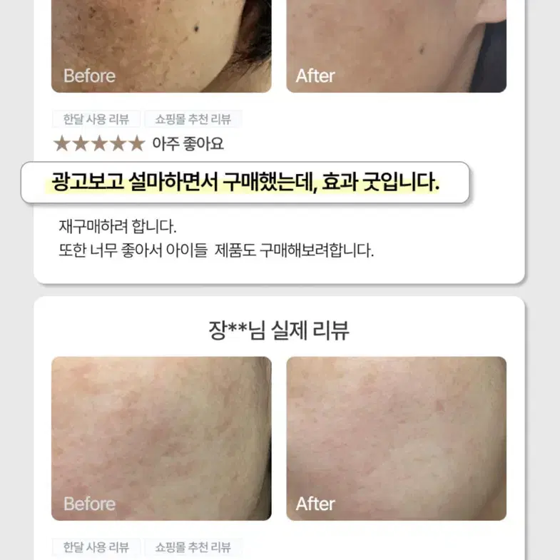 이지듀 앰플 30ml 2개