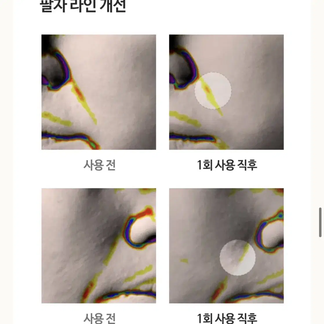 티타샷 2.0 PLUS 리프팅기기 (초특가)